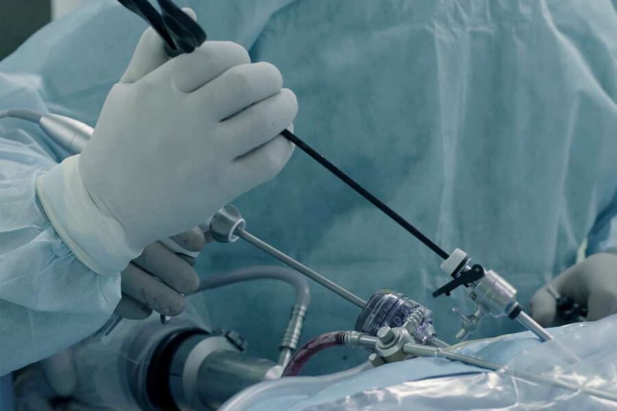 Pilonidal Sinus